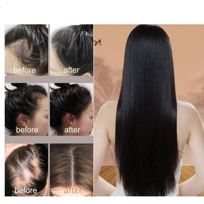 ANTI-HAIR LOSS HAIR SHAMPOO Black What Spirit (Pack of 2)